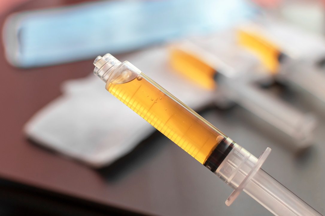 Platelet-Rich Plasma